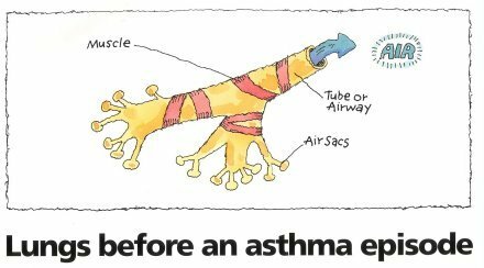 Lungs before an asthma episode